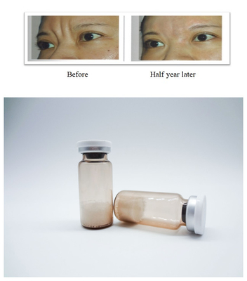 สูตรฉีด Poly L Lactic Acid เติมผิวหน้า การรักษาที่ไม่ใช้การผ่าตัด กําจัดริ้วรอยบนหน้า ปรับปรุงความยืดหยุ่นของผิว