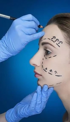 สะดวกผื่นและระบายเส้นคอ ด้วยเครื่องเติมผิวหน้า 70% HA Cross Linked 24mg 30% Calcium Hydroxylapatite