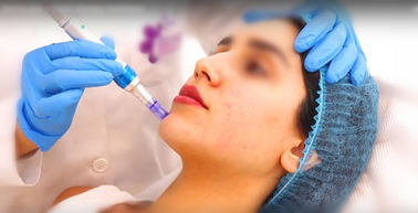 20mg / Ml Non Cross Linked HA Dermal Filler Anti-Aging Ha สำหรับ Hyaluron Pen
