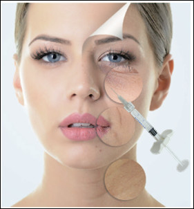1ml 1.1ml Cross Linked Hyaluronic Acid Dermal Fillers สำหรับ Nose Midface Cheek