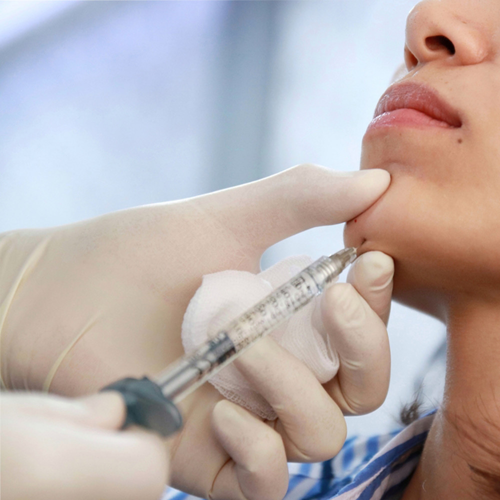 การฉีดเจลไฮยาลูโรนิกทางการแพทย์เจลกรดไฮยาลูโรนิกที่เชื่อมโยง 24mg / Ml