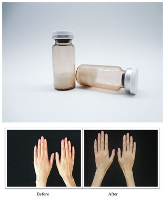 เครื่องเติมผิวหน้าแบบไร้สาระ PLLA Hyaluronic Acid Injectable Gel ออกแบบเพื่อแก้ไขรอยเหี่ยวเรียบและฟื้นฟูปริมาณผิวหน้า